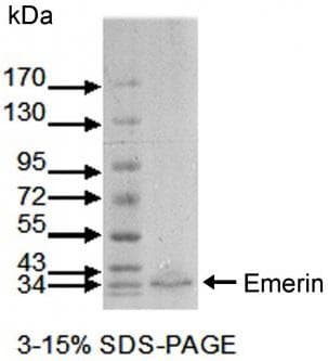 EMD / Emerin Antibody (clone MANEM1(5D10))