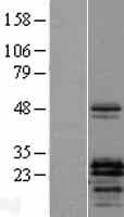 PTHLH / PTHRP Protein (Over-Expression Lysate Myc-DDK (Flag))