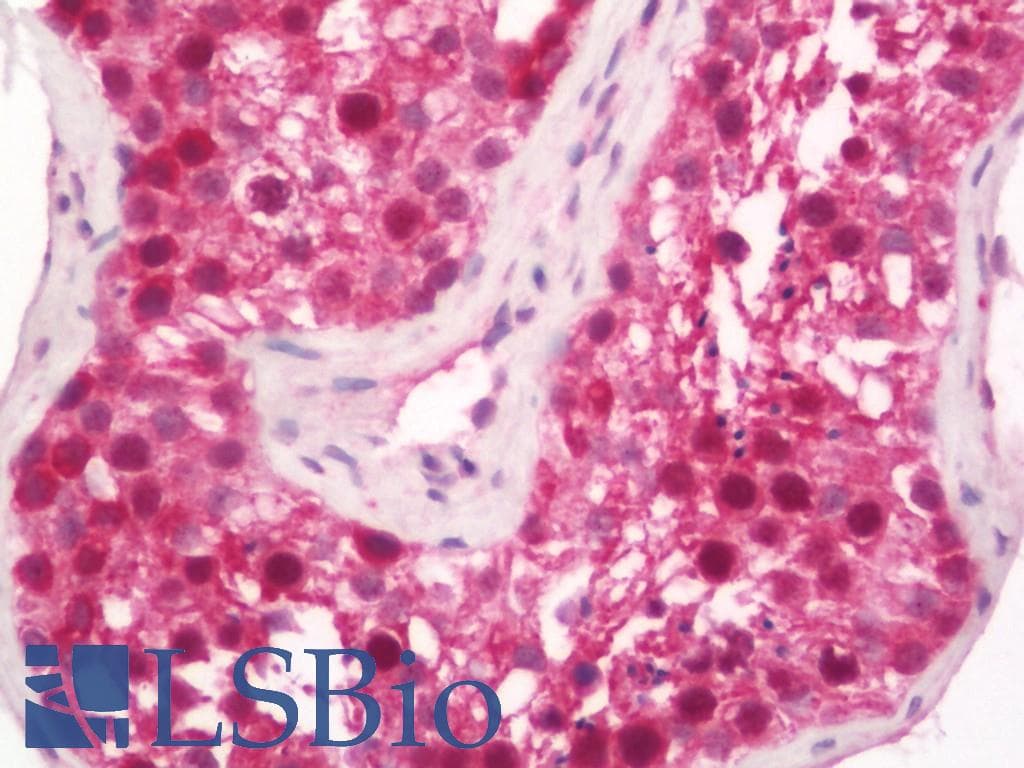 IHC-plus™ Polyclonal Rabbit anti-Human BCKDHA / BCKDE1A Antibody (C-Terminus, IHC, IF, WB)