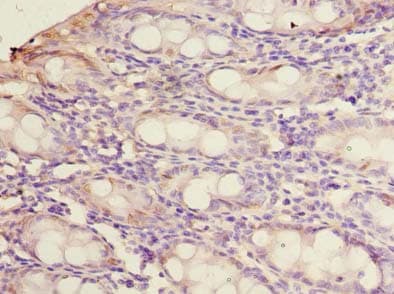 P5CR2 / PYCR2 Antibody