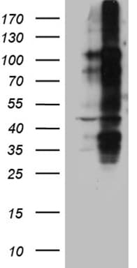 CD30 Antibody