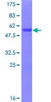 Human ASCL2 Protein (Recombinant GST)