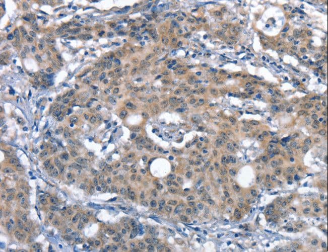 DNAM-1 / CD226 Antibody