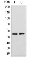 Polyclonal Rabbit anti-Human CYP39A1 Antibody (C-Terminus, IHC, WB)