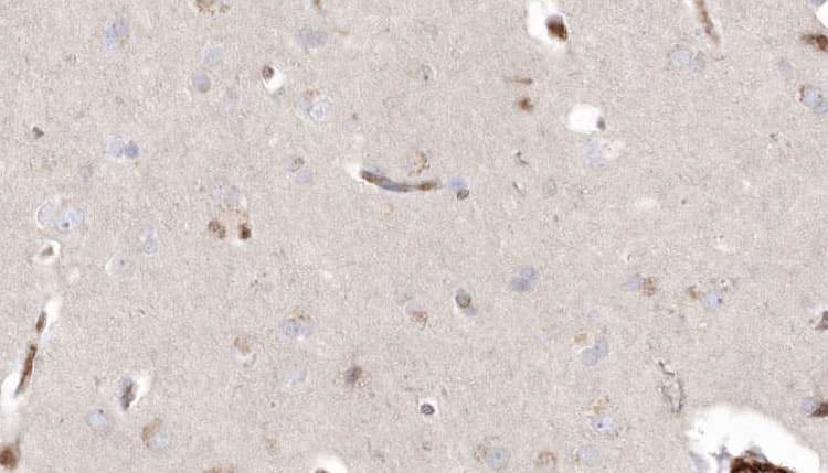 DHRS3 / SDR1 Antibody