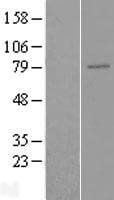 ENPP5 Protein (Over-Expression Lysate Myc-DDK (Flag))
