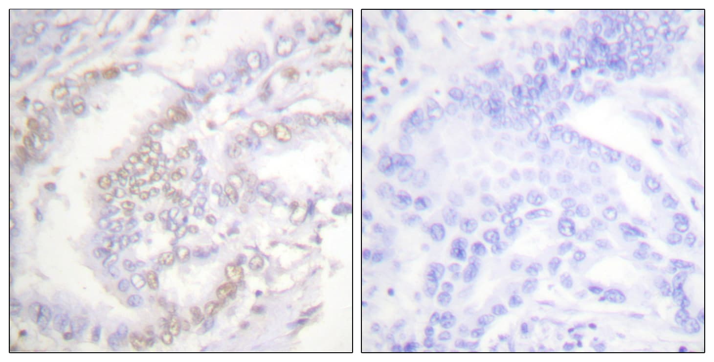 FANCD2 Antibody (phospho-Ser222)