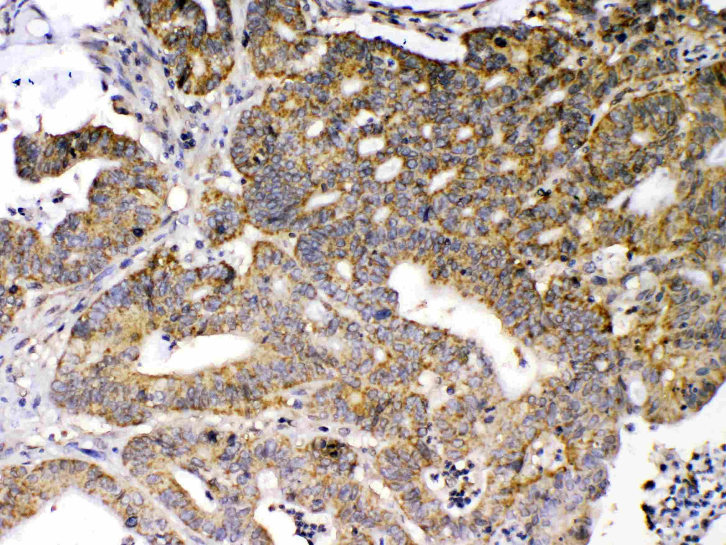 Polyclonal Rabbit anti-Human GAD65 Antibody (IHC, WB)