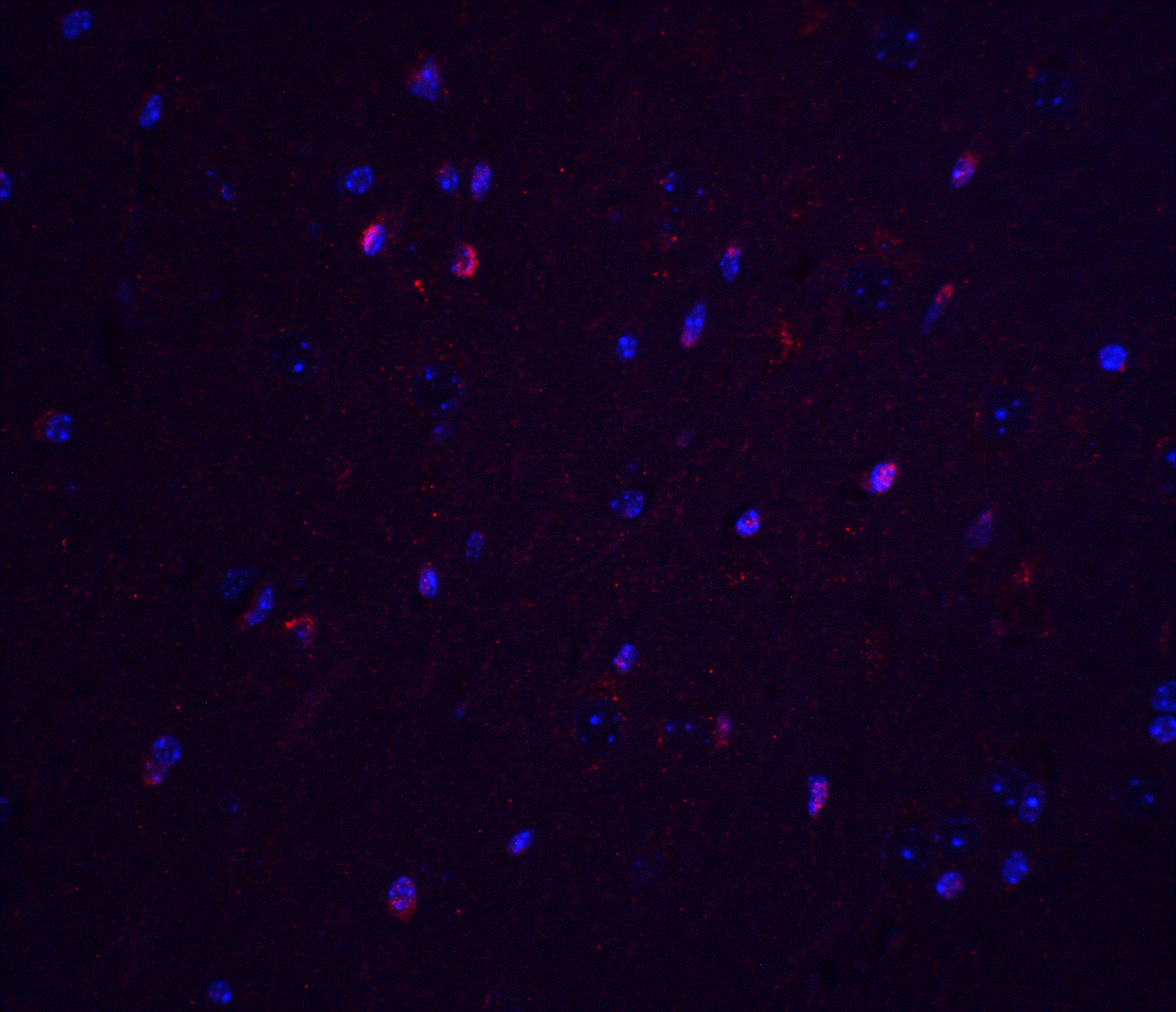 IHC-plus™ Polyclonal Rabbit anti-Human TNFAIP1 Antibody (IHC, IF, WB)