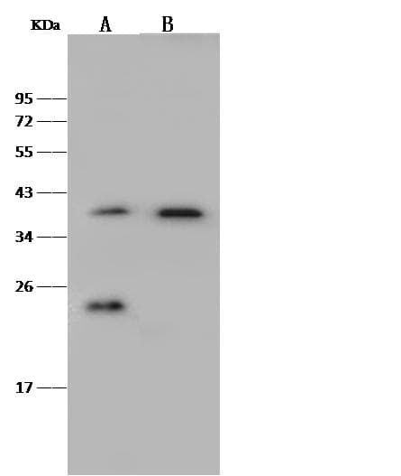 Polyclonal Rabbit anti-Human VPS26A / VPS26 Antibody (Preservative Free, WB)