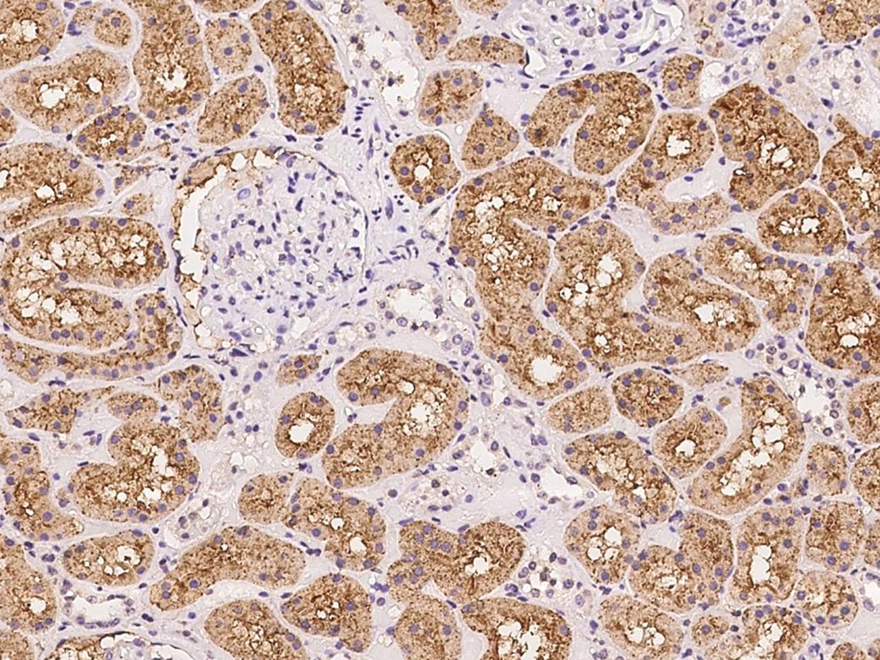 ANKS6 Antibody