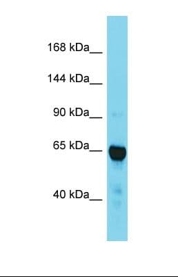 Polyclonal Rabbit anti-Mouse TACC2 Antibody (aa500-549, WB)