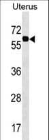 PGM3 Antibody (aa237-263)