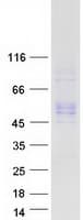 Human ISLR Protein (Recombinant Myc-DDK (Flag))
