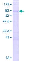 Human KIAA0141 Protein (Recombinant GST)