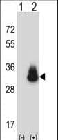 CD66d / CEACAM3 Antibody (aa163-191)