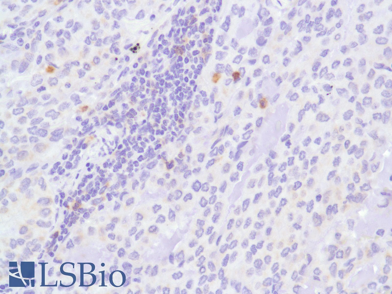 ICOS / CD278 Antibody (C-Terminus, clone SP98)