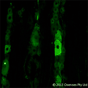 NGFR / CD271 / TNR16 Antibody (clone MC192)