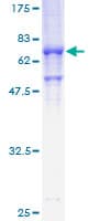 Human STK17B / DRAK2 Protein (Recombinant GST)