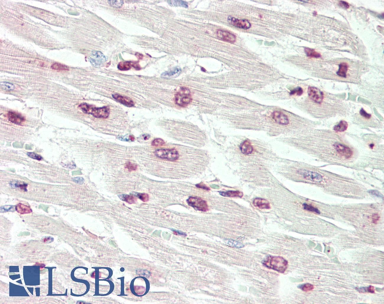 IHC-plus™ RPS6KA3 / RSK2 Antibody (clone 4E10)