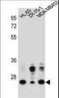 Polyclonal Rabbit anti-Human GFRA4 Antibody (aa156-184, WB)