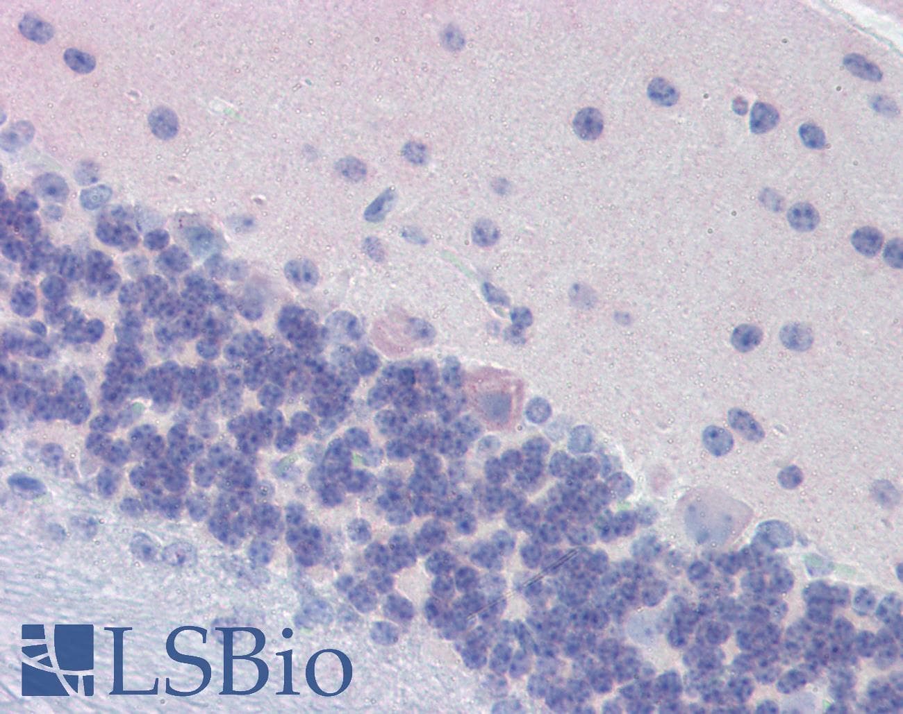 IHC-plus™ Polyclonal Rabbit anti-Mouse GNAO1 Antibody (aa345-354, IHC, WB)