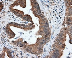 NPR3 Antibody (clone OTI4A1)