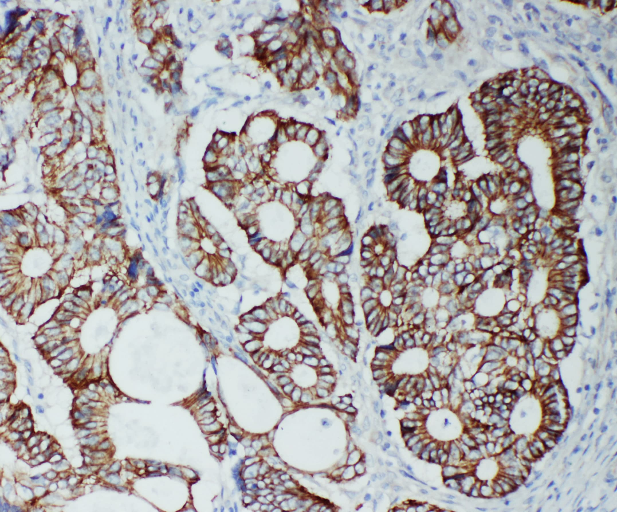 Polyclonal Rabbit anti-Human TJP2 / ZO2 / ZO-2 Antibody (aa1171-1190, IHC, WB)