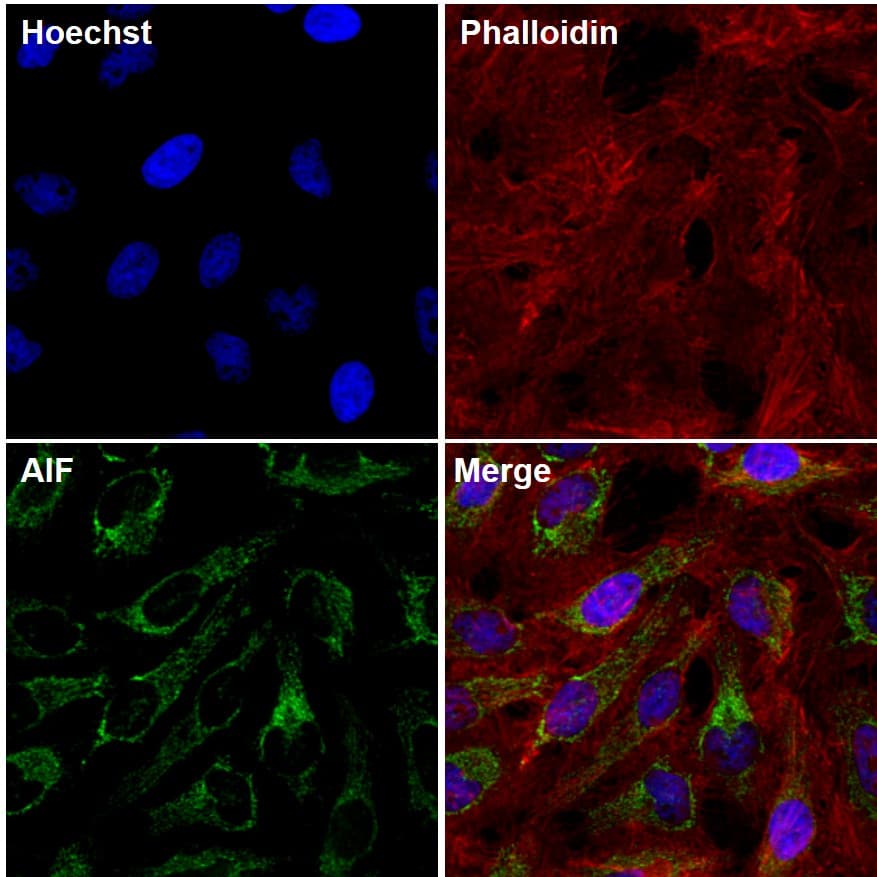 AIFM1 / AIF / PDCD8 Antibody (clone 4E7E11)