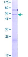 Human SLC25A31 Protein (Recombinant GST)