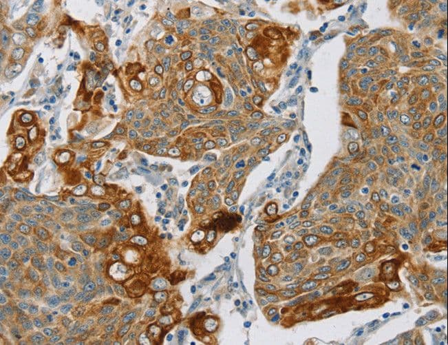 Polyclonal Rabbit anti-Human SMOC2 Antibody (aa 433-446, IHC, WB)