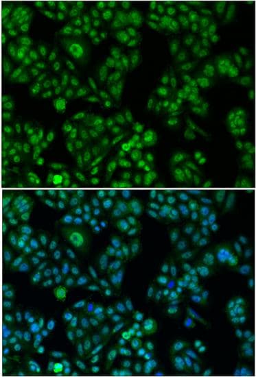 Polyclonal Rabbit anti-Human FOXO1 / FKHR Antibody (IF, WB)