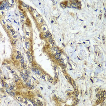APC6 / CDC16 Antibody