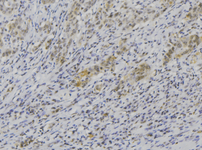 IL1F9 Antibody