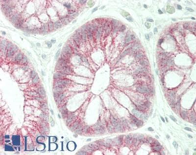 IHC-plus™ CTNNB1 / Beta Catenin Antibody (aa78-106)