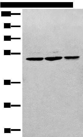 RPL3 / Ribosomal Protein L3 Antibody