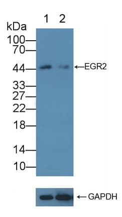 Polyclonal Rabbit anti-Human EGR2 Antibody (aa147-403, WB)