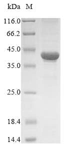 Human TXNDC5 / ERP46 Protein (Recombinant)