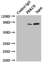 PRKCE / PKC-Epsilon Antibody (aa488-737)