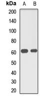 Polyclonal Rabbit anti-Human MUS81 Antibody (WB)
