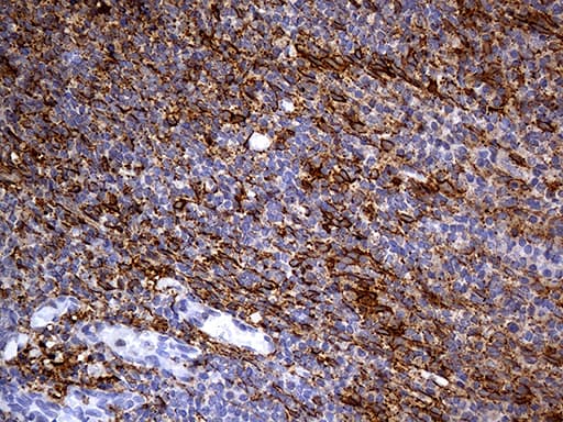 PDPN / Podoplanin Antibody (aa23-131, clone OTI7B4)