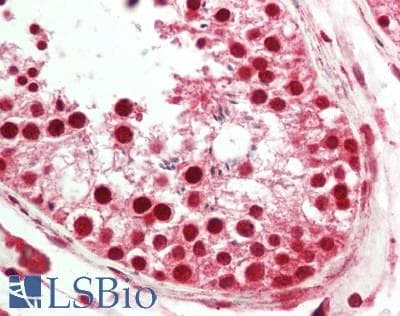 IHC-plus™ Polyclonal Rabbit anti-Human PFTK1 / CDK14 Antibody (aa67-96, IHC, WB)