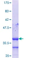 Human HIC1 Protein (Recombinant GST, N-terminus)