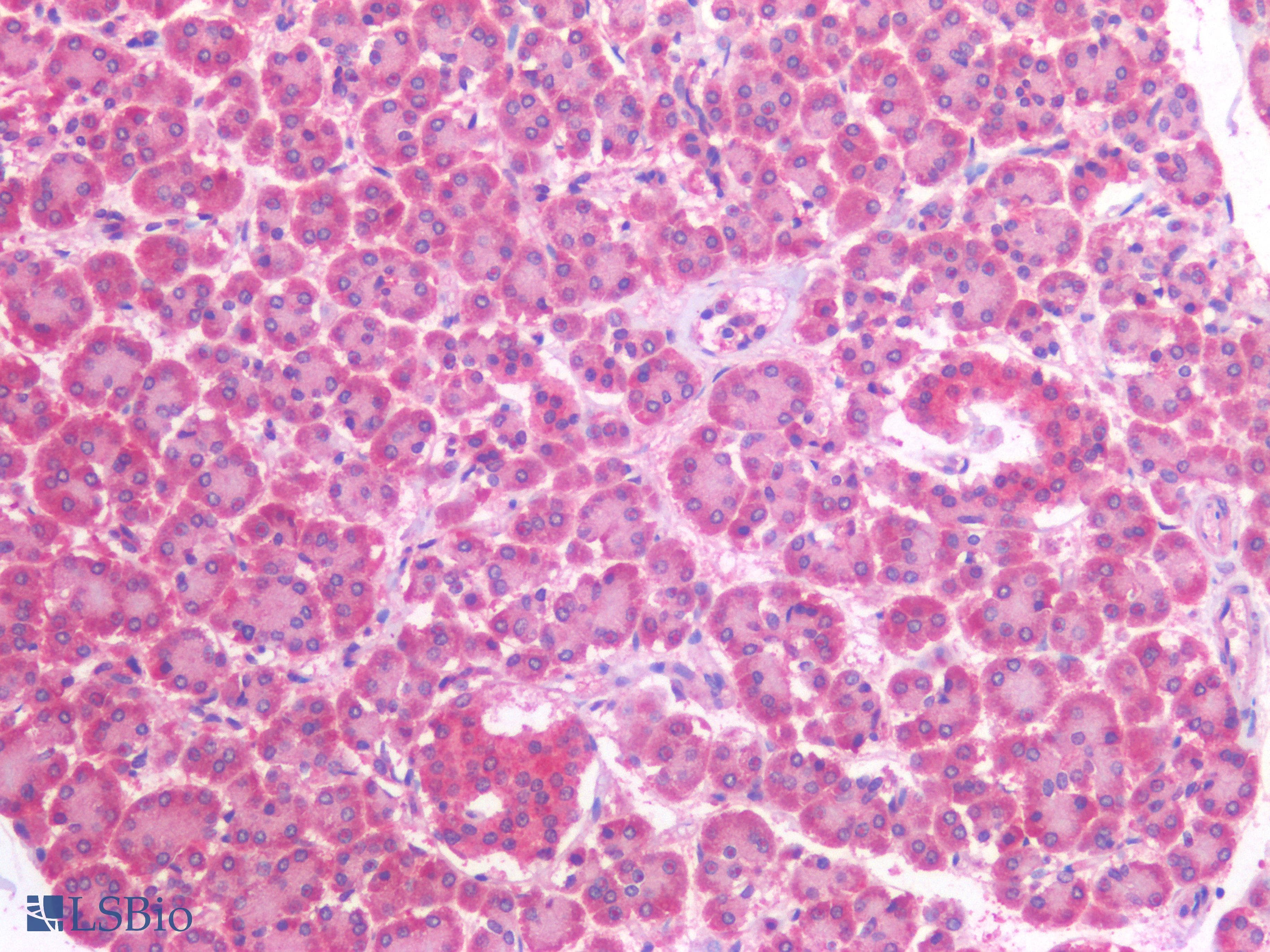 PathPlus™ Polyclonal Goat anti-Human PIK3CA / PI3K Alpha Antibody (aa800-1000, IHC)