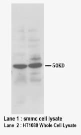 HPSE / Heparanase Antibody (N-Terminus)