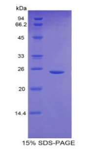 Mouse GCLC Protein (Recombinant His)