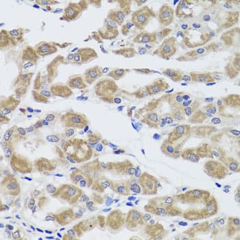 KLK3 / PSA Antibody