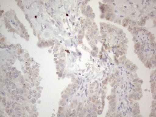 PD-L2 / PDCD1LG2 / CD273 Antibody (clone OTI12C7)