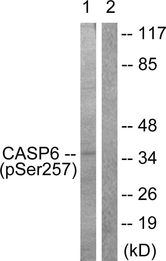 Polyclonal Rabbit anti-Human CASP6 / Caspase 6 Antibody (phospho-Ser257, IHC, IF, WB)
