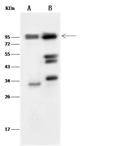 INSR / Insulin Receptor Antibody (Preservative Free)